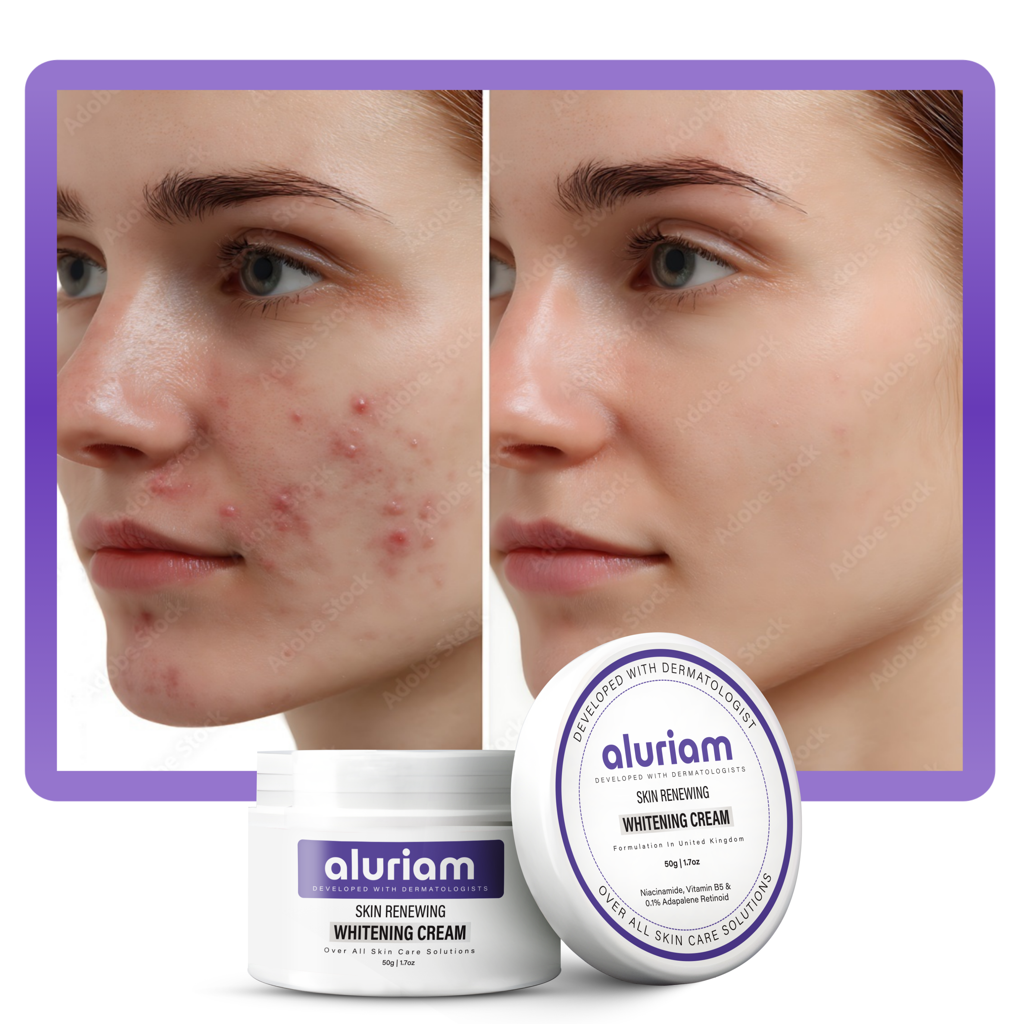 Skin Renewing Whitening Cream