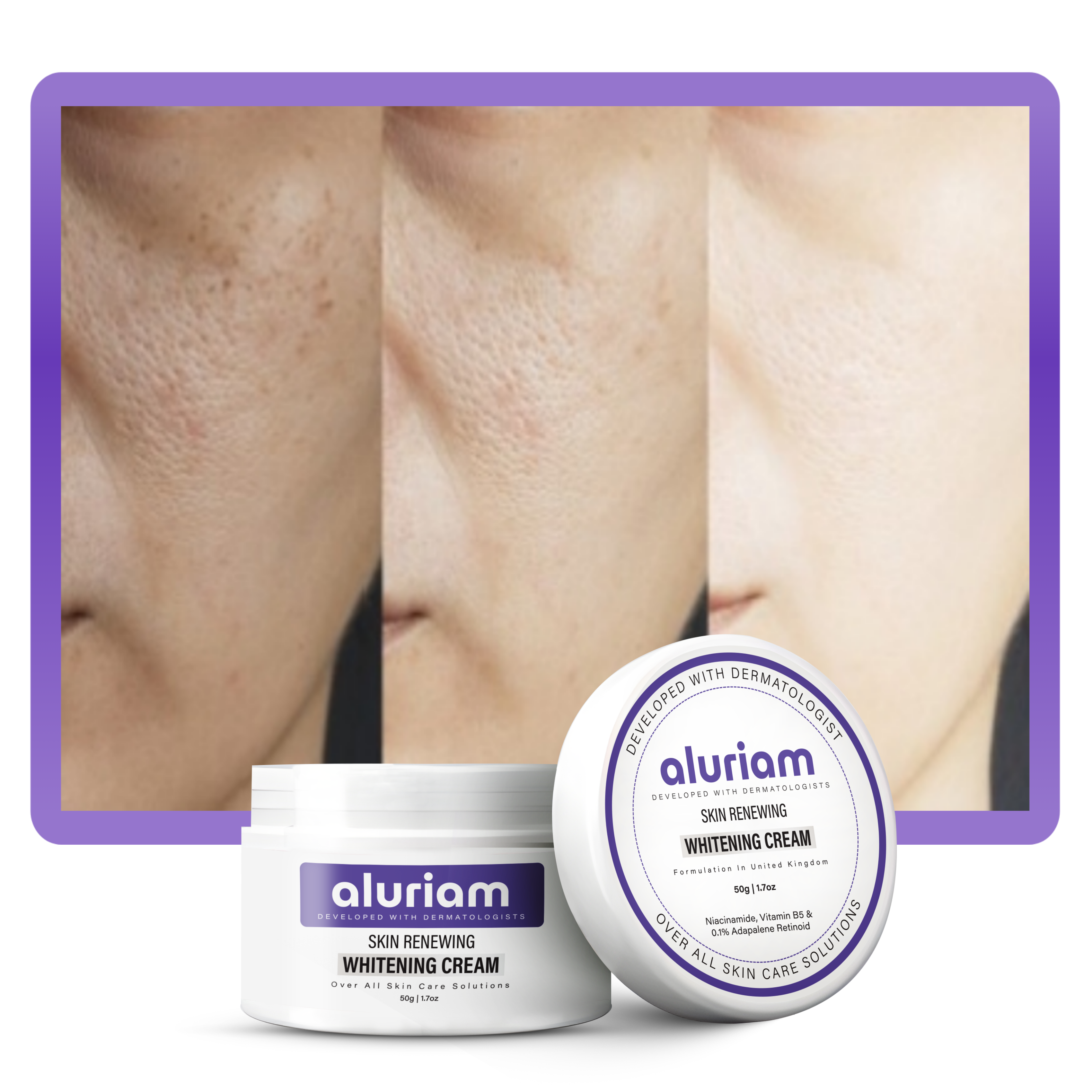 Skin Renewing Whitening Cream