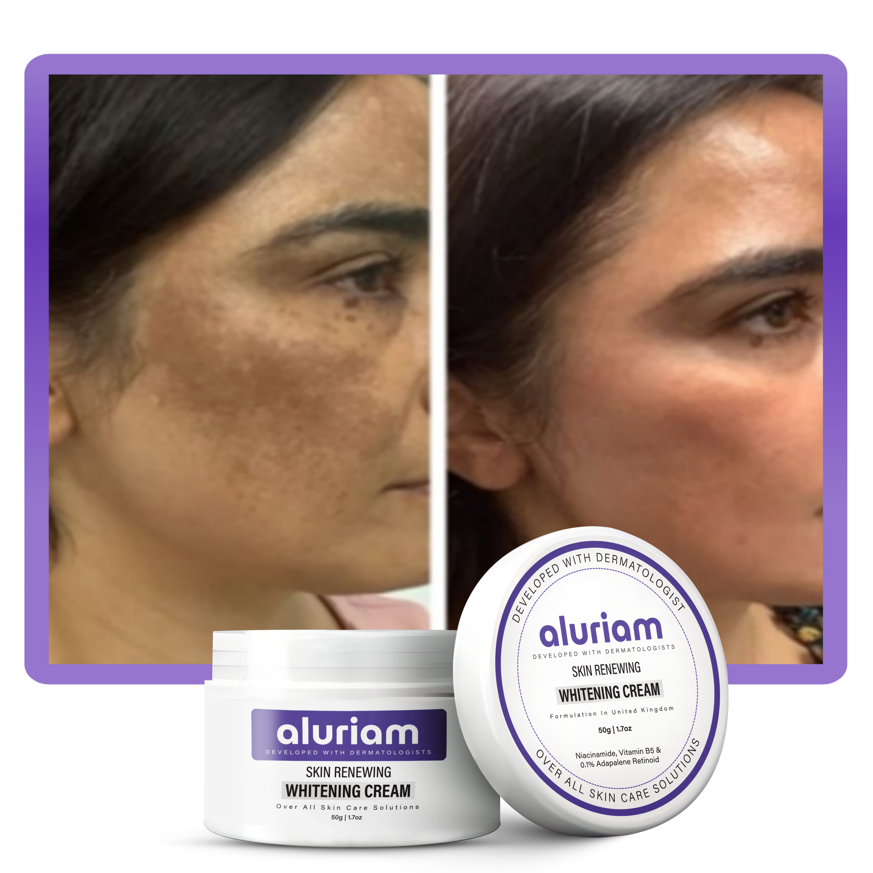 Skin Renewing Whitening Cream