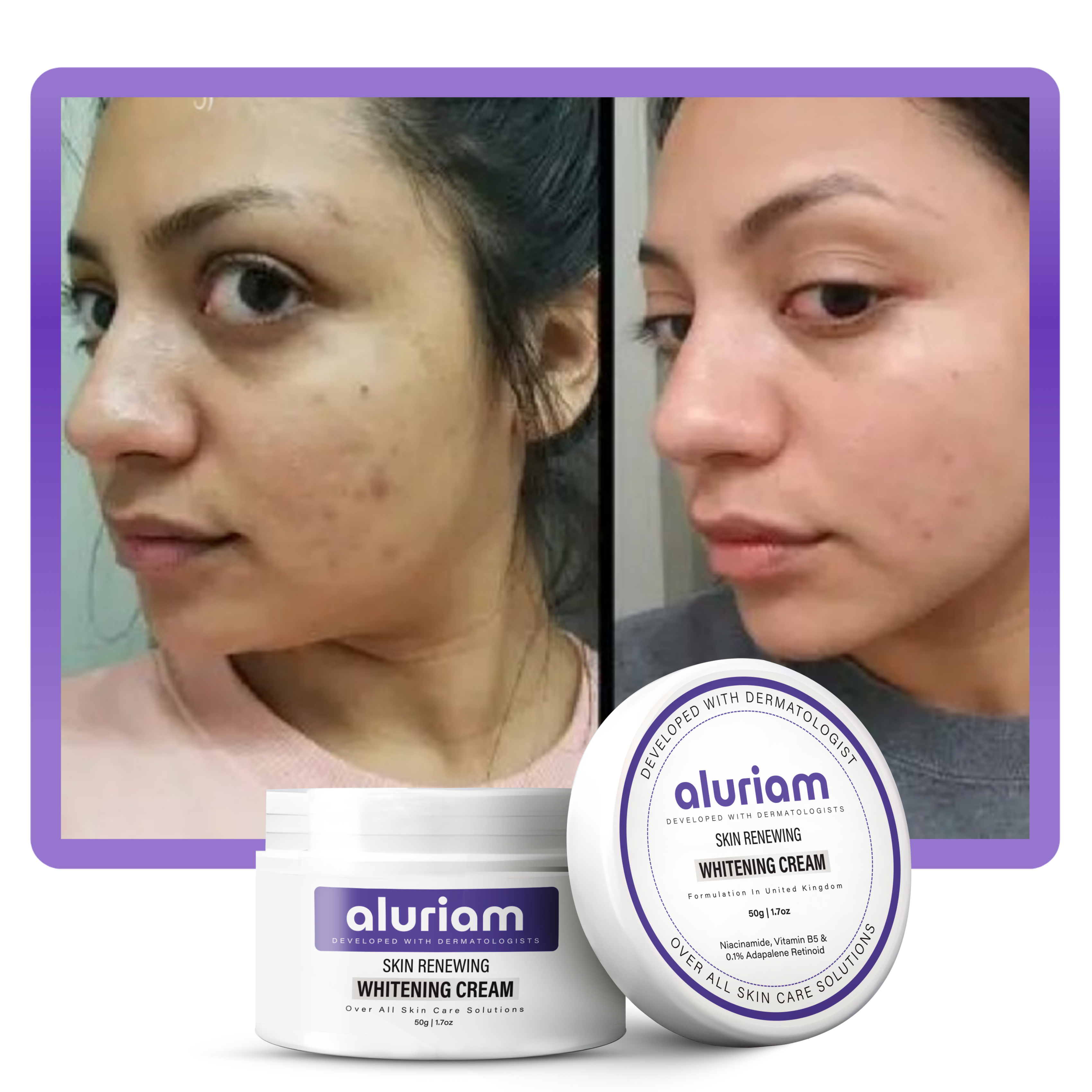 Skin Renewing Whitening Cream