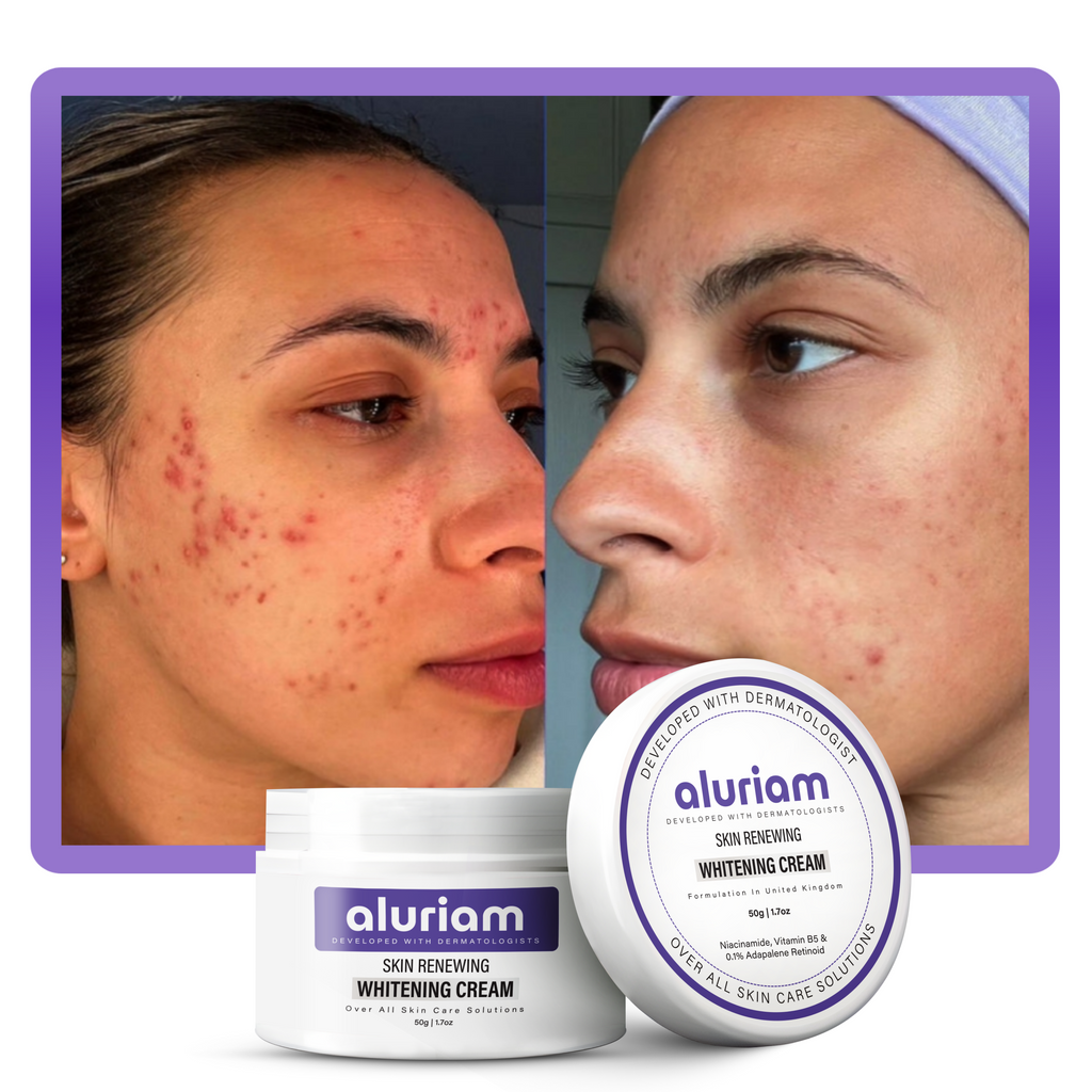 Skin Renewing Whitening Cream