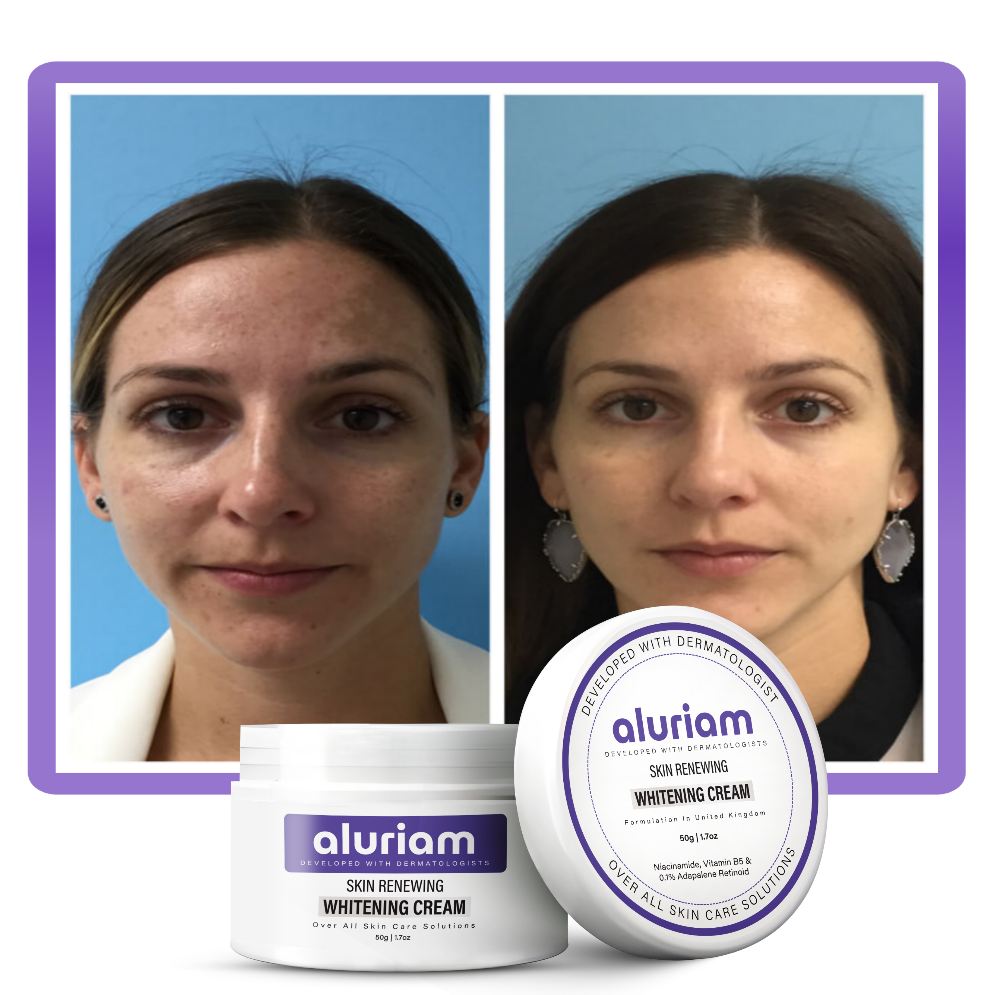 Skin Renewing Whitening Cream