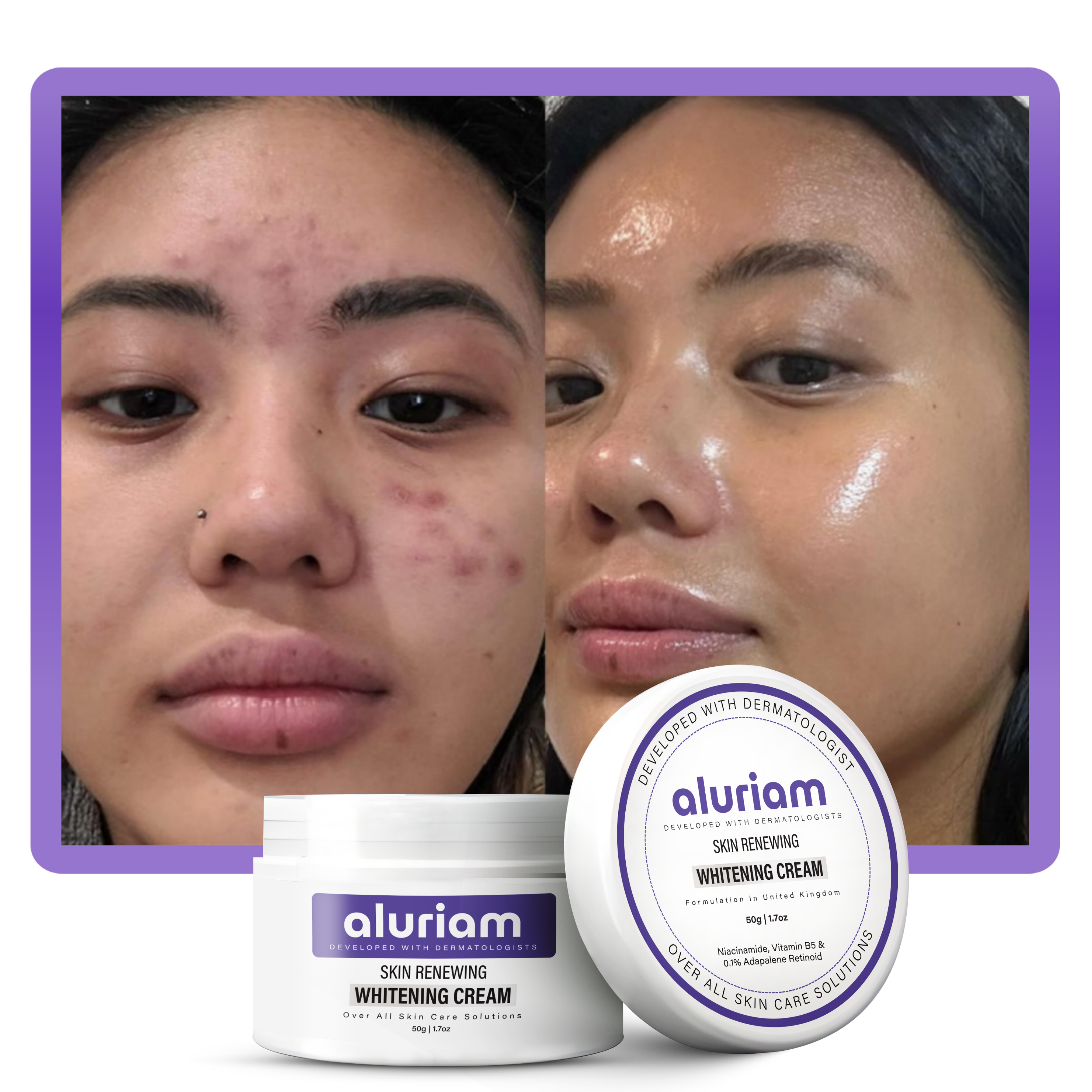 Skin Renewing Whitening Cream
