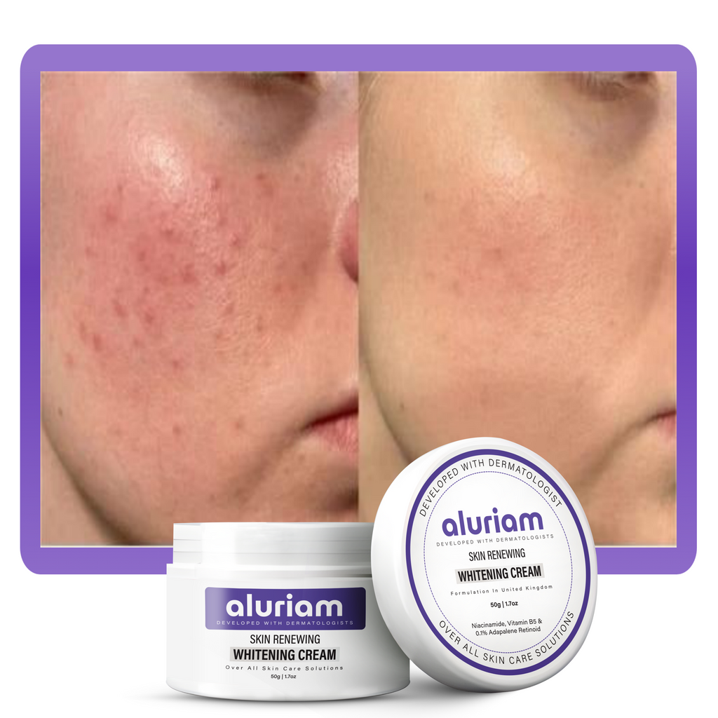 Skin Renewing Whitening Cream