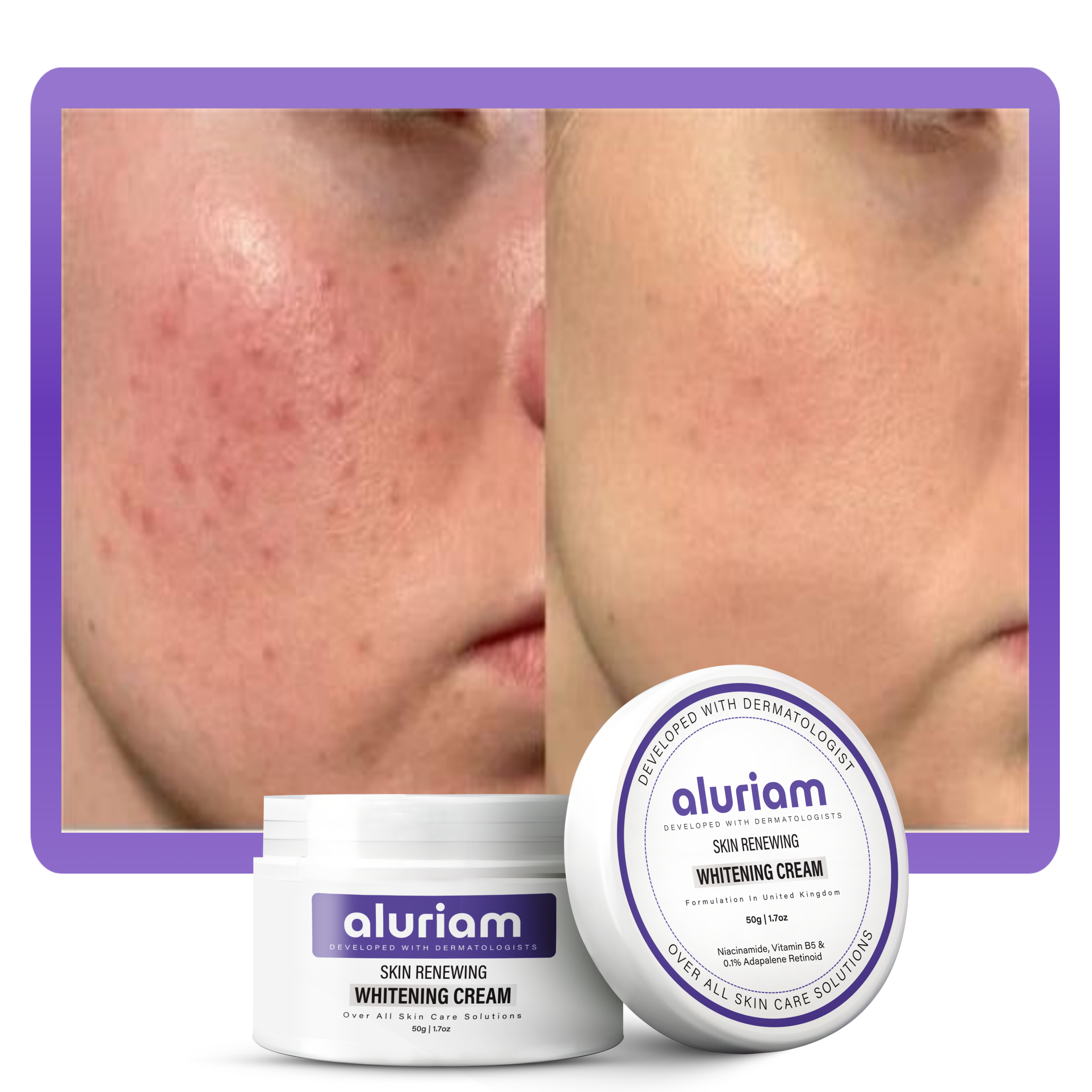 Skin Renewing Whitening Cream
